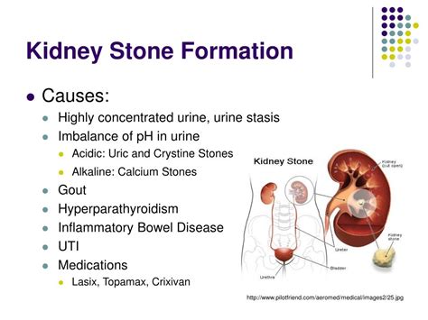 Can You Ejaculate a Kidney Stone? Exploring the Boundaries of Human Physiology and Imagination