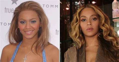 Has Beyoncé Had Plastic Surgery? Exploring the Rumors and Realities